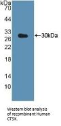 Cathepsin K Antibody
