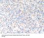Cathepsin K Antibody