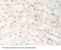 Cathepsin K Antibody