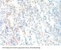 Cathepsin K Antibody