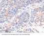 Cathepsin K Antibody