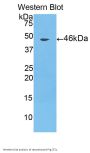 Cathepsin L1 (CTSL) Antibody