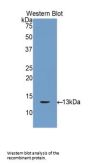 Gap Junction Beta-3 Protein / CX31 (GJB3) Antibody