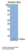 Gap Junction Beta-3 Protein / CX31 (GJB3) Antibody