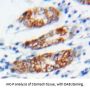 Gap Junction Beta-3 Protein / CX31 (GJB3) Antibody