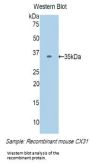 Gap Junction Beta-3 Protein / CX31 (GJB3) Antibody