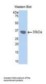 Gap Junction Beta-3 Protein / CX31 (GJB3) Antibody