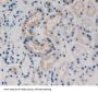 Keratin 15 (KRT15) Antibody