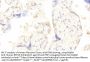 Keratin 23 (KRT23) Antibody