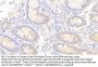 Keratin 23 (KRT23) Antibody
