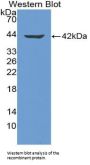 Neuromedin B (NMB) Antibody