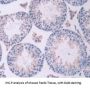 Oncostatin M (OSM) Antibody