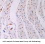 Oncostatin M (OSM) Antibody