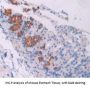 Oncostatin M (OSM) Antibody