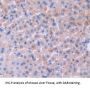 Oncostatin M (OSM) Antibody