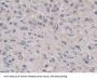 Pepsinogen C (PGC) Antibody