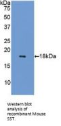 Somatostatin (SST) Antibody
