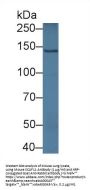 Protein SCAF11 (SCAF11) Antibody