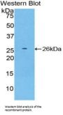 Protein SCAF11 (SCAF11) Antibody