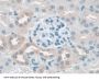 Protein SCAF11 (SCAF11) Antibody