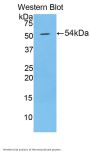 Desmoglein 1 (DSG1) Antibody