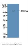 Desmoglein 3 (DSG3) Antibody