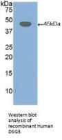 Desmoglein 3 (DSG3) Antibody