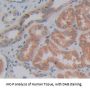 Desmoglein 3 (DSG3) Antibody