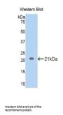 Endothelin 1 (EDN1) Antibody