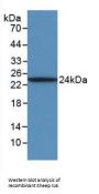 IL6 Antibody
