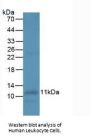 Interleukin 8 (IL8) Antibody