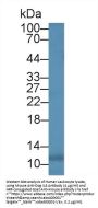 Interleukin 8 (IL8) Antibody
