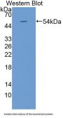 Kallikrein 4 (KLK4) Antibody