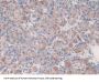 Kallikrein 6 (KLK6) Antibody
