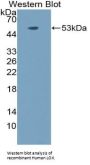 Lysyl Oxidase (LOX) Antibody