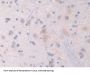 Neuropilin 1 (NRP1) Antibody