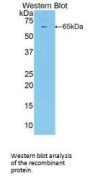 Polybromo 1 (PBRM1) Antibody
