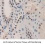 Polybromo 1 (PBRM1) Antibody