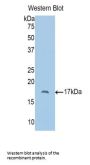 Polybromo 1 (PBRM1) Antibody