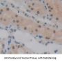 Polybromo 1 (PBRM1) Antibody