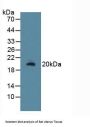 R-Spondin 1 (RSPO1) Antibody