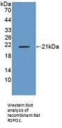 R-Spondin 1 (RSPO1) Antibody