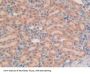 R-Spondin 1 (RSPO1) Antibody