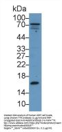 Transthyretin (TTR) Antibody