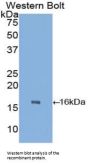 Transthyretin (TTR) Antibody