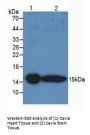 Transthyretin (TTR) Antibody