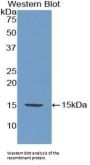 Adrenomedullin Antibody