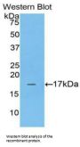 Adrenomedullin (ADM) Antibody