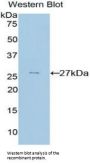 Prion Protein (PRNP) Antibody