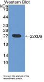 Pronociceptin (PNOC) Antibody